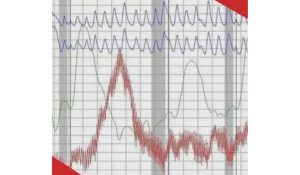 Resultado polígrafo Marelbys Meza/RCN Radio